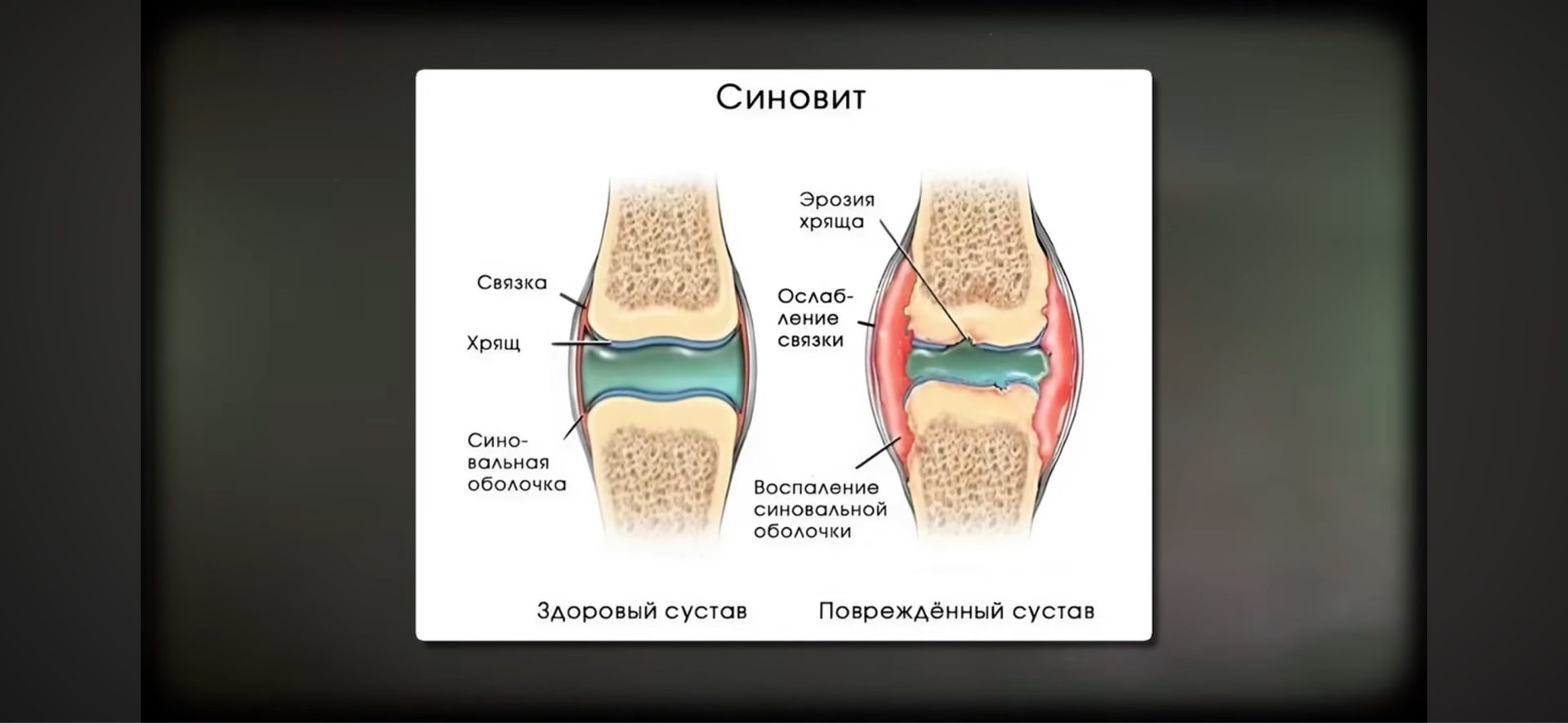 Вчера и сегодня очень сильно проблема с ногой коленка на ле…
